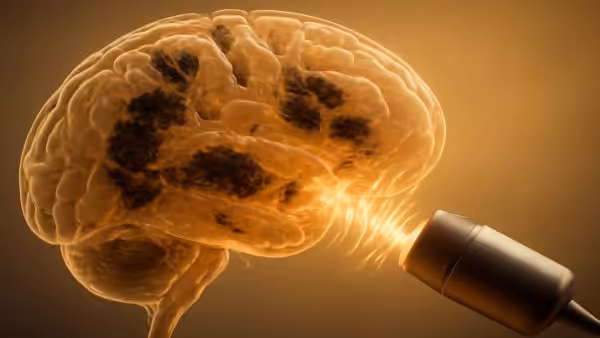 Breakthrough study shows sound stimulation may help clear Alzheimer’s plaques